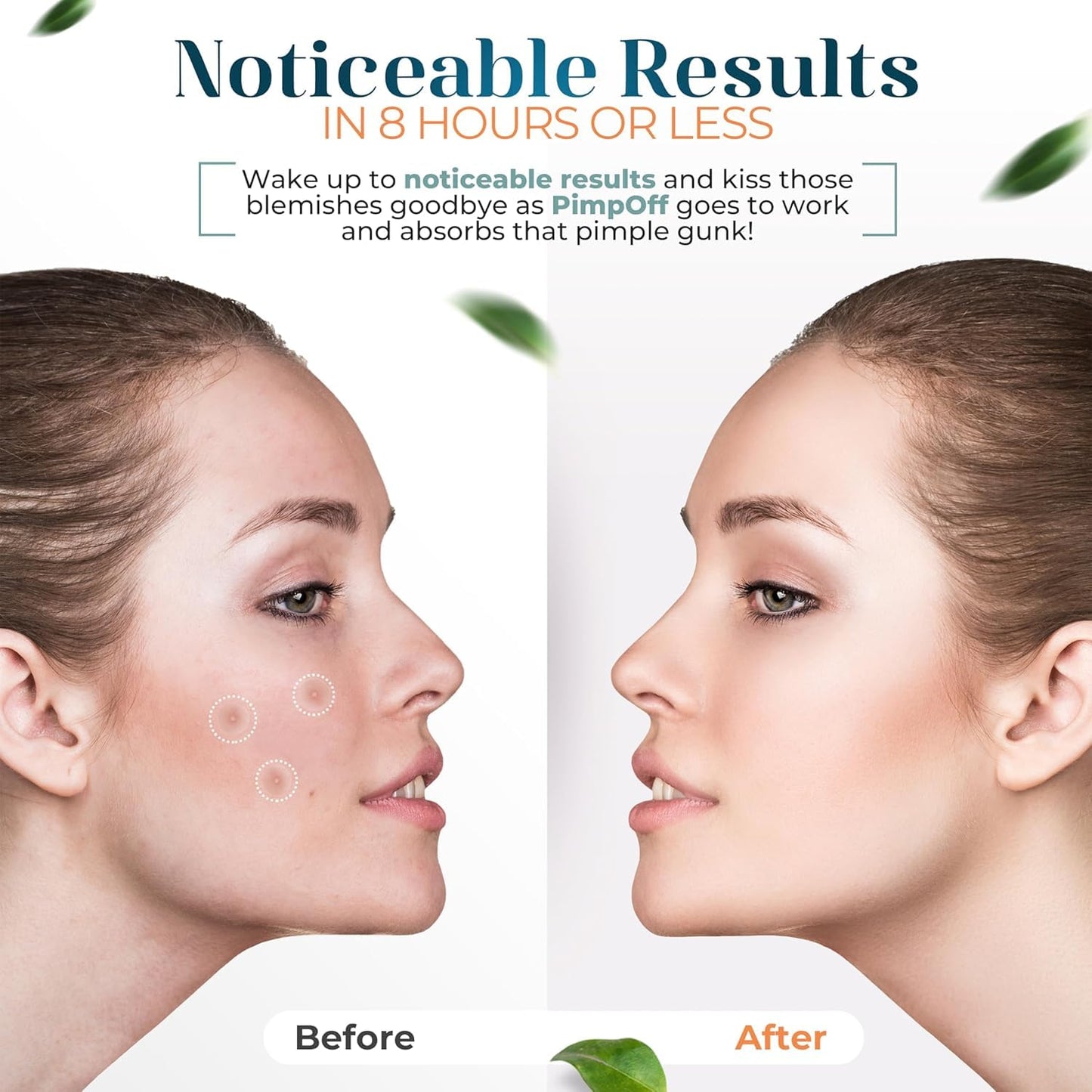 Clear Hydrocolloid Acne Patches - Effective Blemish Coverage with Tea Tree Oil - Acne Dots for Face - Skin Care Solution - Zit and Breakout Treatment (84 Patches With Mirror)