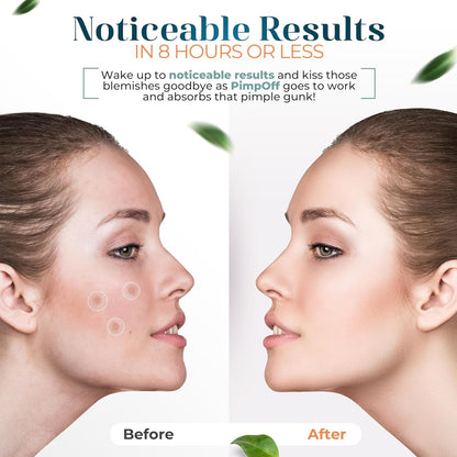 Clear Hydrocolloid Acne Patches - Effective Blemish Coverage with Tea Tree Oil - Acne Dots for Face - Skin Care Solution - Zit and Breakout Treatment (84 Patches With Mirror)